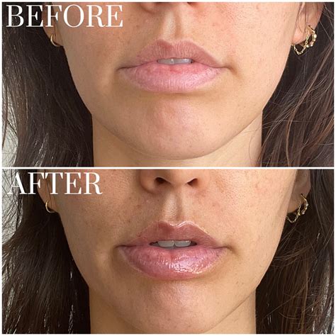 Ion Peptides Purity Specifications and Manufacturing Standards for Cosmetic Formulation